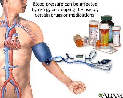 What Is High Blood Pressure and How Is It Treated