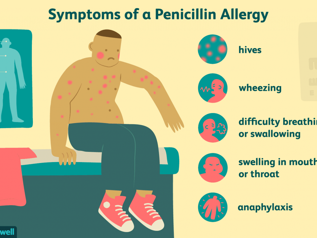 penicillin allergies   eadbdeabafdc