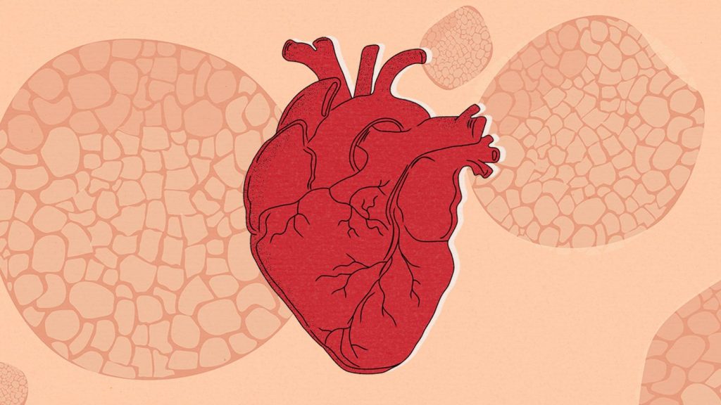 psoriasis and heart disease the hidden connection