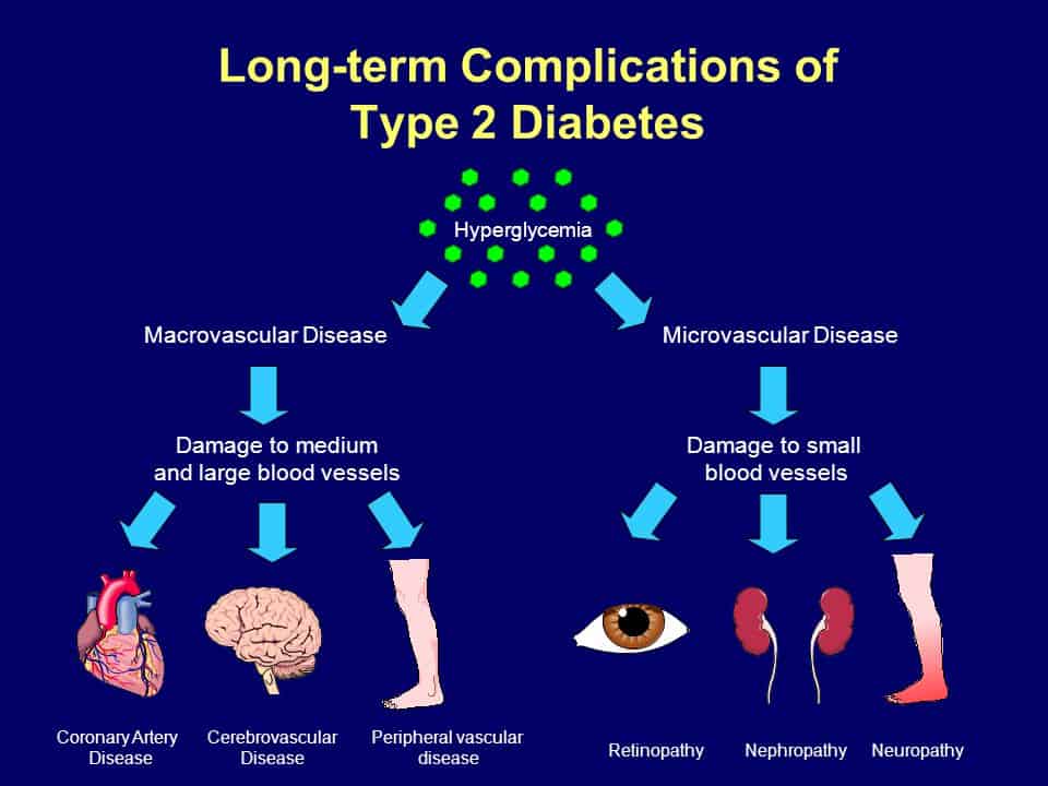 Long termComplicationsofTypeDiabetes