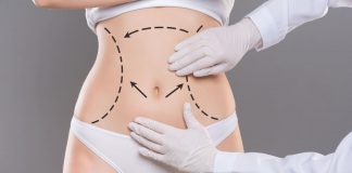 What Is The Difference Between Liposuction And Tummy Tuck