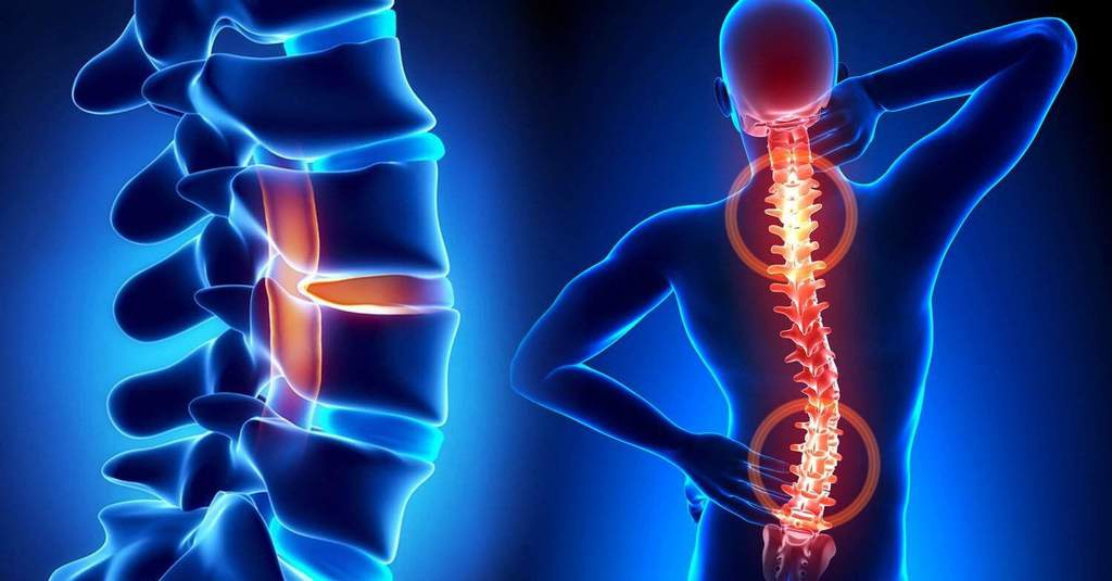 stem cell for spine pain